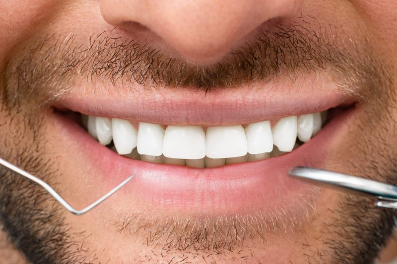Close up of a man smiling with periodontal probe and mouth mirror.