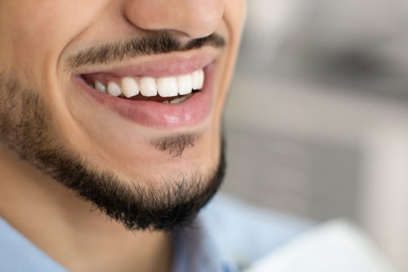 Man smiling after Pinhole Gum Surgery