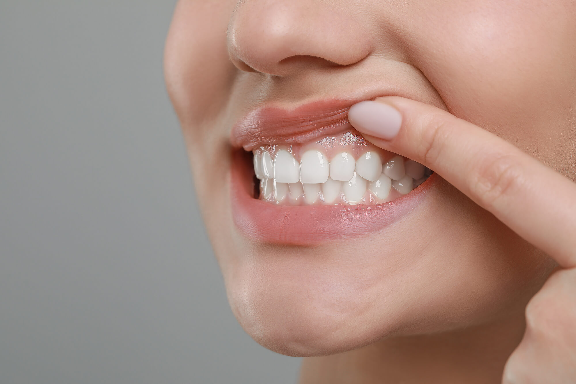 woman showing healthy gums after treatment for gum disease