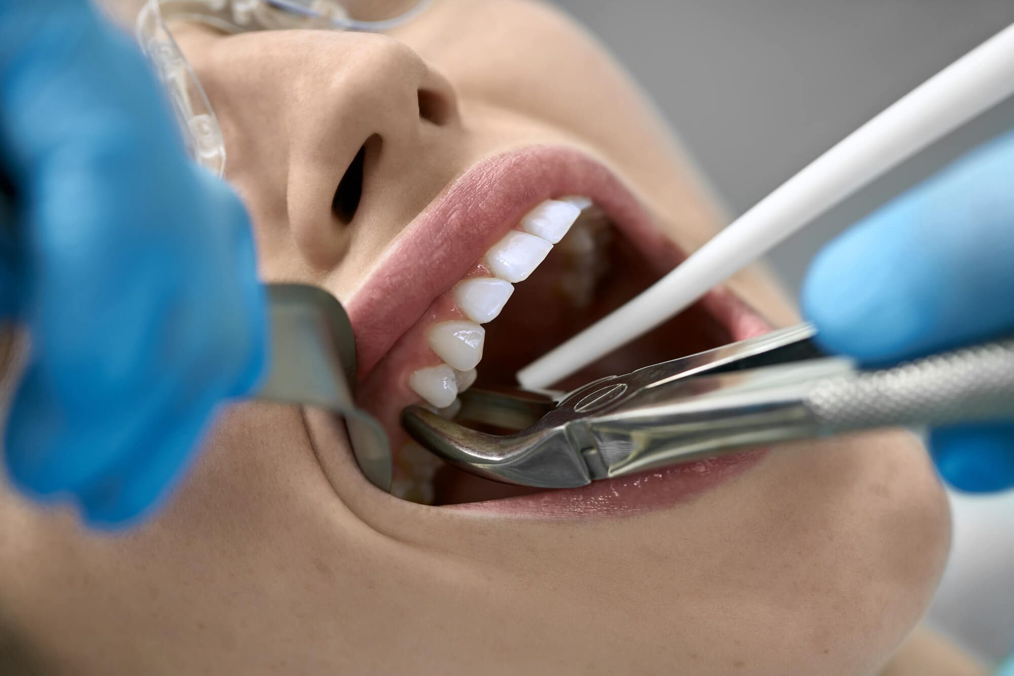 Local Anesthetics What Your Dentist Wants You to Know About Tooth