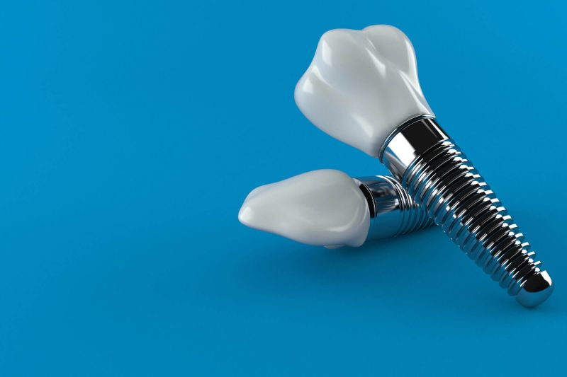 Affordable-dental-implants-over-blue-background